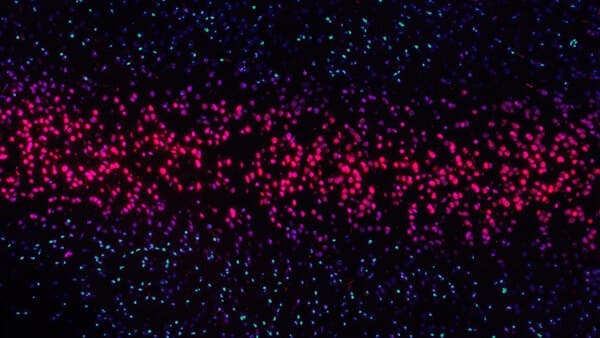 Fluorescence microscopy of cells