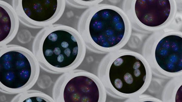 Helio Genomics partners with Syneos Health to accelerate liver cancer detection