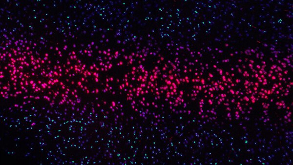 Fluorescence microscopy of cells