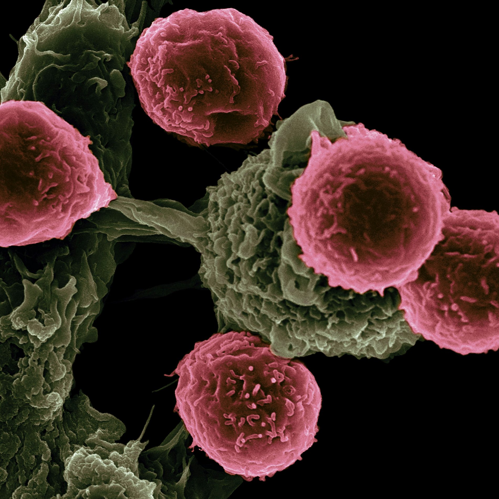 Illustration of a cancer cell among blood cells
